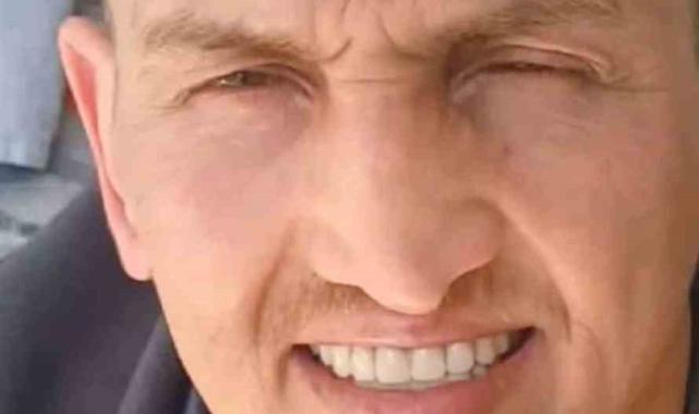İstanbul'da burun estetiği ameliyatının ardından hayatını kaybetti