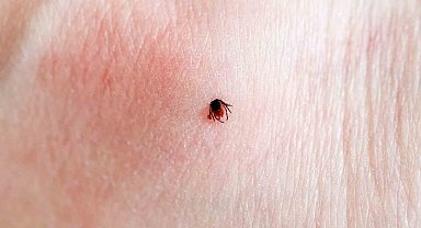 Sıcaklar keneyi erken uyandırdı: "Belirtilerin ortaya çıkmasını beklemeyin"