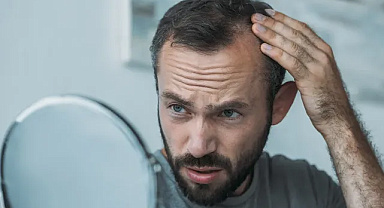 KELLİK TEDAVİSİNDE DEVRİM! Yeni Hapta Yüzde 86 Başarı, FDA Onayı Bekleniyor