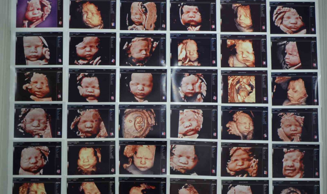 7 yıllık bebek hasreti "kişiye özel" tedaviyle son buldu